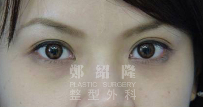 eye sample001