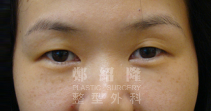 eye sample002