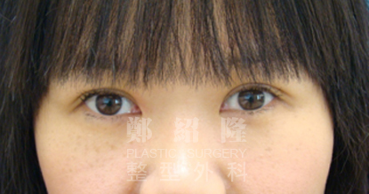 eye sample003