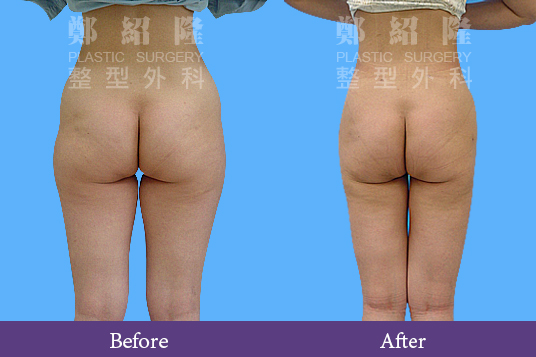 bodycut new