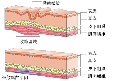 botox injection part