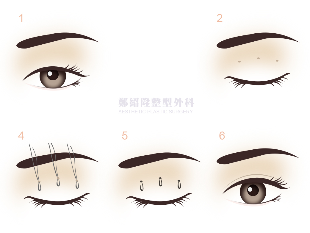 eye sample