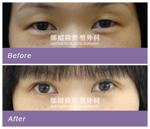 eyesample004