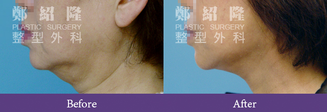 Face001