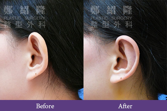 ear002 1