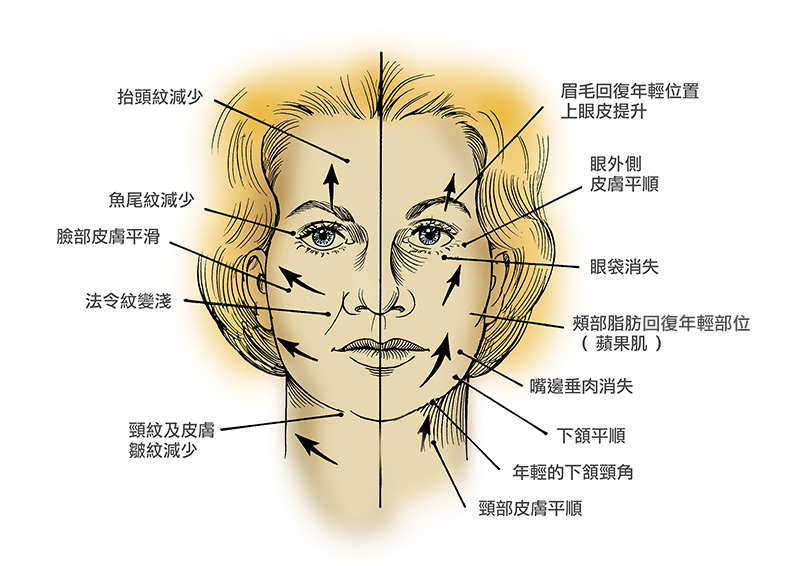 facepart002