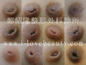 invertednipple