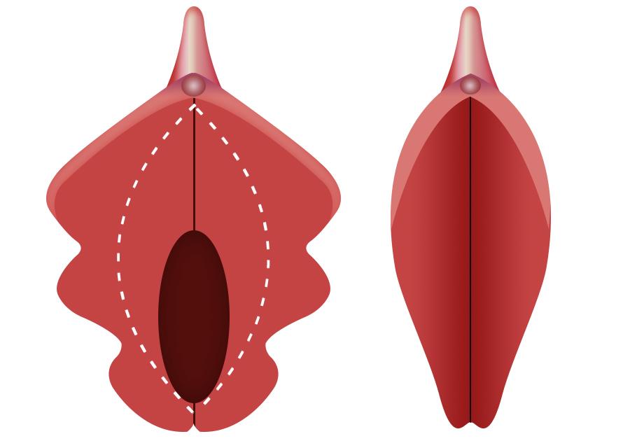 lip001