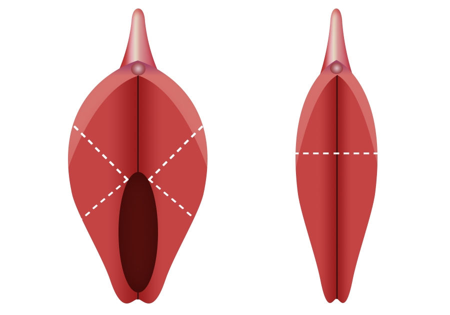 lip002